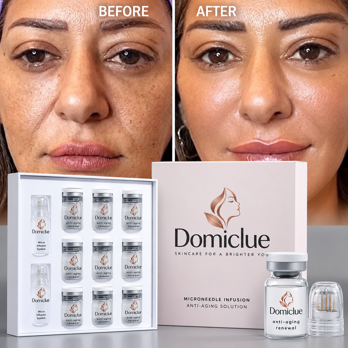 Domiclue Micro-Infusion Serum Kit